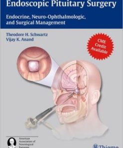 Endoscopic Pituitary Surgery: Endocrine, Neuro-Ophthalmologic and Surgical Management