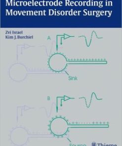 Microelectrode Recording in Movement Disorder Surgery