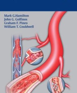 Handbook of Bleeding and Coagulation for Neurosurgery