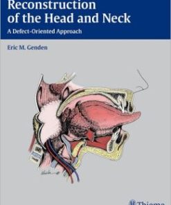 Reconstruction of the Head and Neck: A Defect-Oriented Approach (PDF)