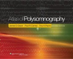 Atlas of Polysomnography, 2nd Edition (PDF)