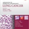 Advances in Surgical Pathology: Lung Cancer (PDF)