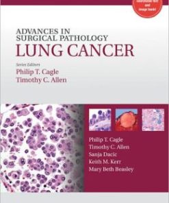 Advances in Surgical Pathology: Lung Cancer (PDF)