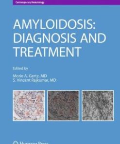 Amyloidosis: Diagnosis and Treatment (PDF)