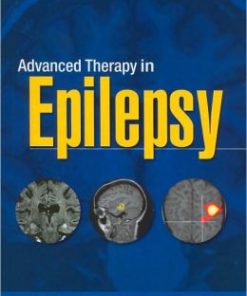 Advanced Therapy in Epilepsy