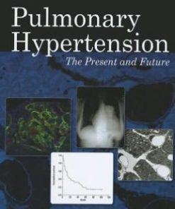 Pulmonary Hypertension: The Present and Future (PDF)