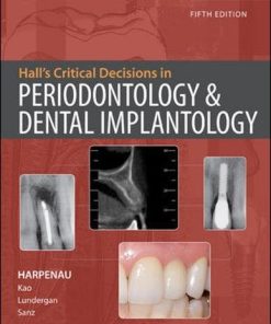 Hall’s Critical Decisions in Periodontology & Dental Implantology, 5th Edition (EPUB)