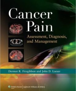 Cancer Pain: Assessment, Diagnosis, and Management (PDF)