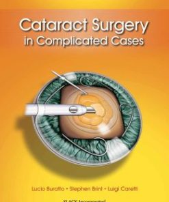 Cataract Surgery in Complicated Cases (PDF)