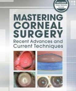 Mastering Corneal Surgery: Recent Advances and Current Techniques (PDF)