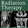 Handbook of Palliative Radiation Therapy (EPUB)