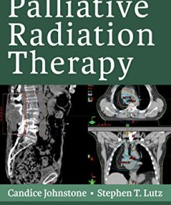 Handbook of Palliative Radiation Therapy (EPUB)