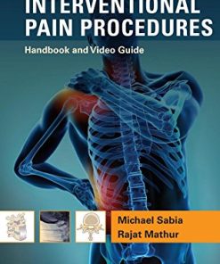 Interventional Pain Procedures: Handbook and Video Guide (PDF)