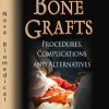 Bone Grafts: Procedures, Complications and Alternatives (Surgery – Procedures, Complications, and Results) (PDF)