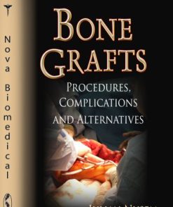 Bone Grafts: Procedures, Complications and Alternatives (Surgery – Procedures, Complications, and Results) (PDF)