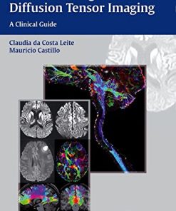 Diffusion Weighted and Diffusion Tensor Imaging: A Clinical Guide (PDF)