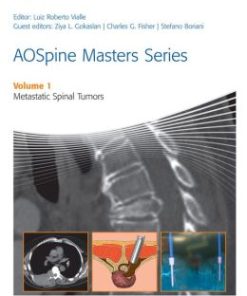 AOSpine Masters Series Volume 1: Metastatic Spinal Tumors (PDF)