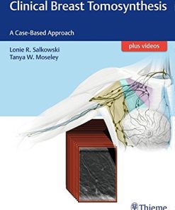 Clinical Breast Tomosynthesis: A Case-Based Approach (EPUB)