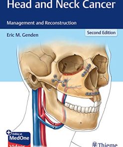 Head and Neck Cancer: Management and Reconstruction, 2nd Edition (PDF)