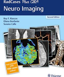 RadCases Plus Q&A Neuro Imaging (HQ Image PDF)