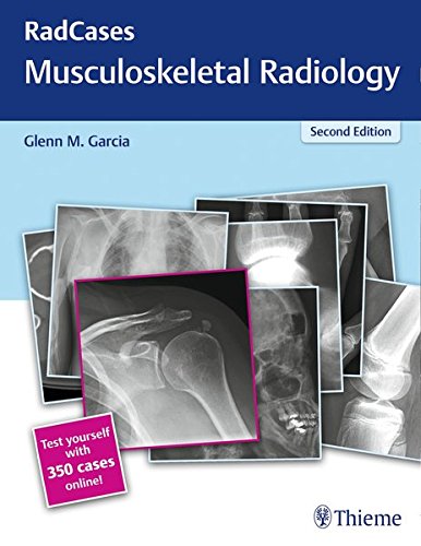 RadCases Q&A Musculoskeletal Radiology, 2nd Edition (PDF) RadCases Q&A Musculoskeletal Radiology, 2nd Edition (PDF)