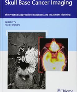 Skull Base Cancer Imaging: The Practical Approach to Diagnosis and Treatment Planning (PDF)