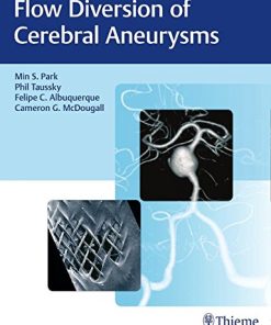 Brain Arteriovenous Malformations and Arteriovenous Fistulas (EPUB)