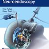 Controversies in Neuroendoscopy (PDF)