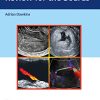 Ultrasound Q&A Review for the Boards (PDF)