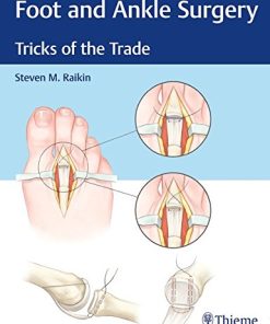 Foot and Ankle Surgery: Tricks of the Trade (EPUB)