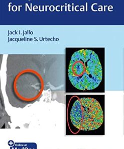 The Jefferson Manual for Neurocritical Care (PDF)