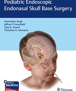 Pediatric Endoscopic Endonasal Skull Base Surgery (PDF)