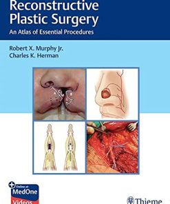 Reconstructive Plastic Surgery: An Atlas of Essential Procedures (PDF Book+Videos)