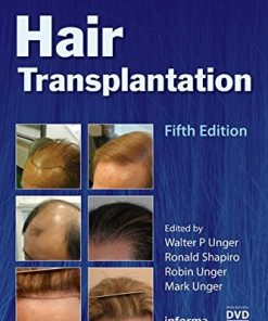 Hair Transplantation, 5ed (PDF Book + Videos)