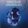 Operative Management of Vascular Anomalies (EPUB)