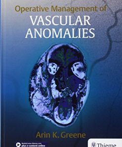 Operative Management of Vascular Anomalies (EPUB)