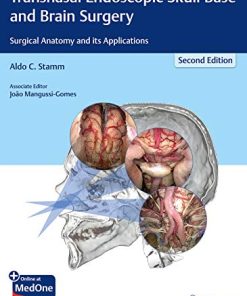 Transnasal Endoscopic Skull Base and Brain Surgery: Surgical Anatomy and its Applications (PDF)