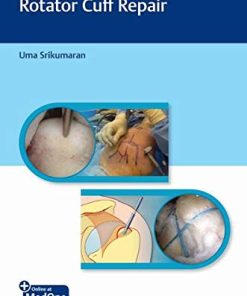 Video Atlas of Arthroscopic Rotator Cuff Repair (PDF Book + Videos)