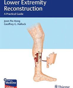 Lower Extremity Reconstruction: A Practical Guide (PDF Book+Videos)