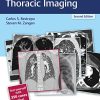 RadCases Plus Q&A Thoracic Imaging, 2nd Edition (PDF)