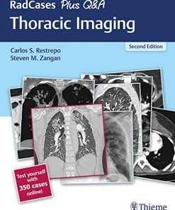 RadCases Plus Q&A Thoracic Imaging, 2nd Edition (PDF)