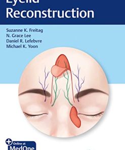 Eyelid Reconstruction (PDF)