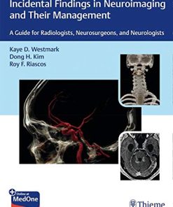 Incidental Findings in Neuroimaging and Their Management: A Guide for Radiologists, Neurosurgeons, and Neurologists (PDF)