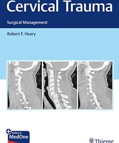 Cervical Trauma: Surgical Management (PDF)