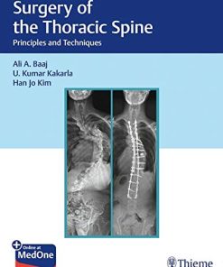 Surgery of the Thoracic Spine: Principles and Techniques (PDF)