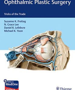 Ophthalmic Plastic Surgery: Tricks of the Trade (PDF)