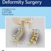 Cervical Spine Deformity Surgery (PDF)