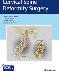 Cervical Spine Deformity Surgery (PDF)