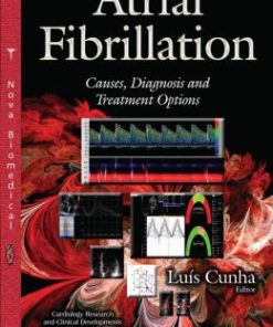 Atrial Fibrillation: Causes, Diagnosis and Treatment Options