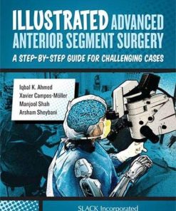 Illustrated Advanced Anterior Segment Surgery: A Step-by-Step Guide for Challenging Cases (PDF)